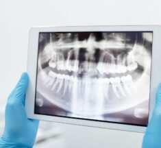 Dental 3D Scanner From Shining 3D